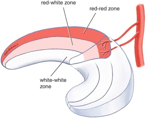 Zones van de meniscus