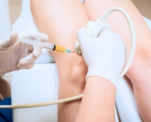 PRP Echogeleide injectie